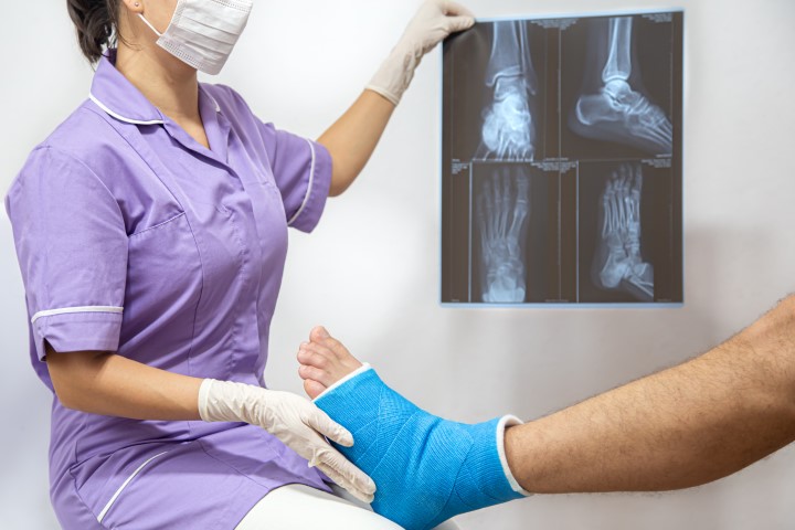 radiografia pies